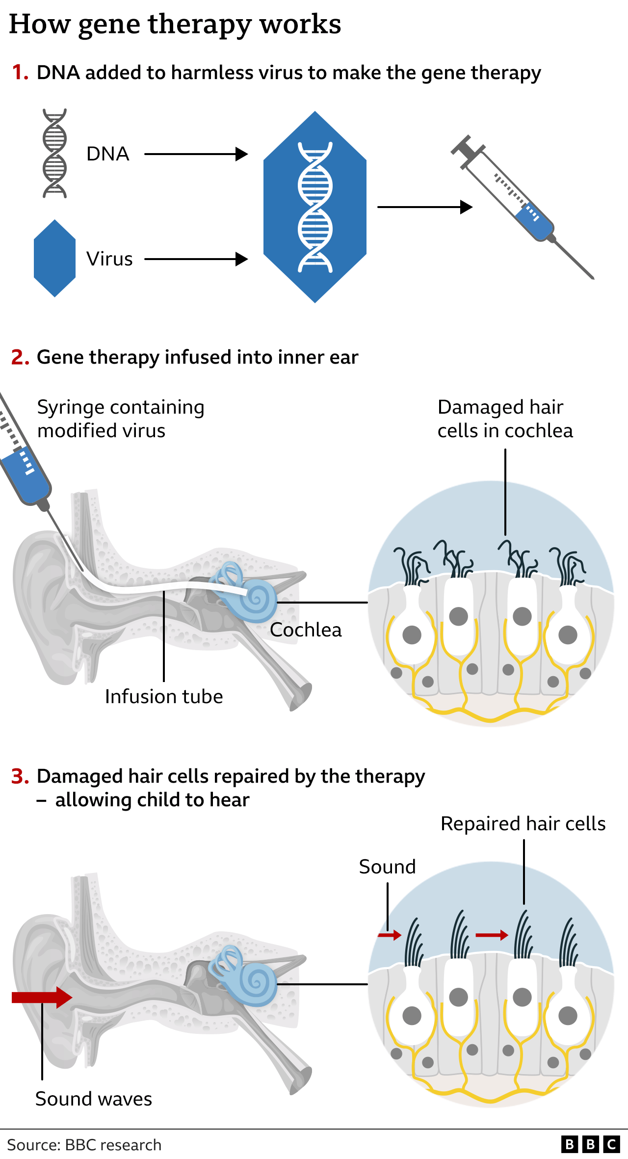 Graphic of how gene therapy works